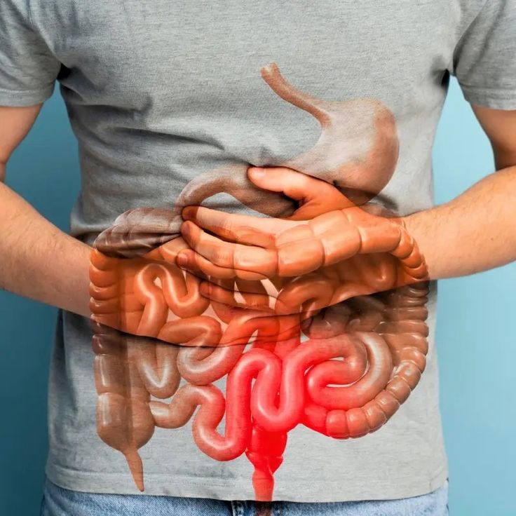 ZENVITA™ - GUT SUPPORT CAPSULE