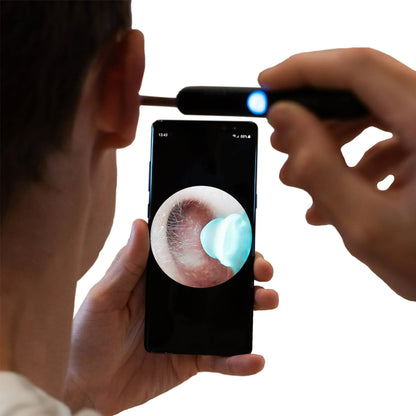 ZENVITA™   - PROFESSIONAL EAR WAX REMOVAL TOOL